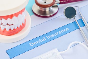 What To Do When You Max Out Your Dental Insurance?