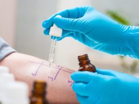 Does Insurance Cover Allergy Tests