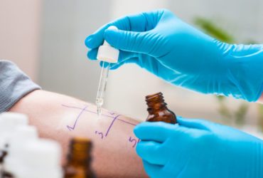 Does Insurance Cover Allergy Tests