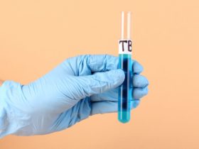Does Medical Insurance Cover TB Tests?
